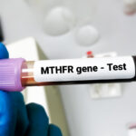 MTHFR – What it is and Why You Need to Know About it